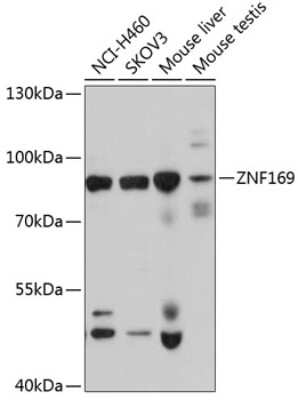 Western Blot: ZNF169 AntibodyBSA Free [NBP2-93181]